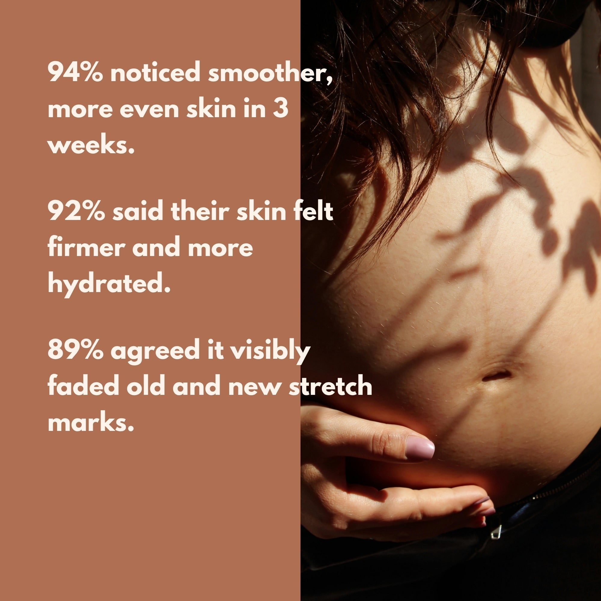 GLO Mama Stretch Mark Roll-On Oil Centella Striover Pregnancy Safe 50ml