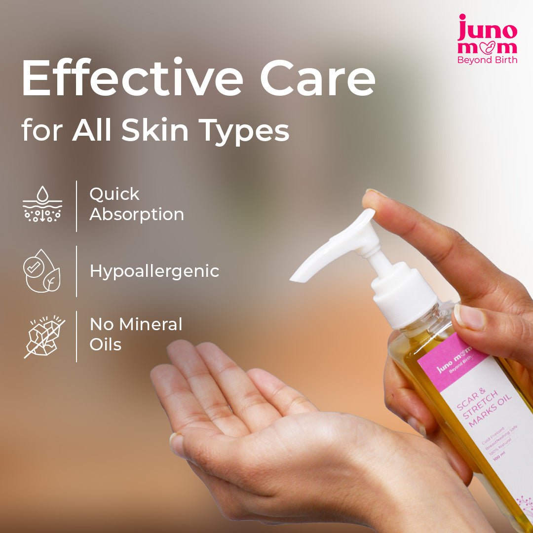 Juno Mom Scar & Stretch Marks Oil Reduces Scars Rejuvenating Herbal 3.38oz